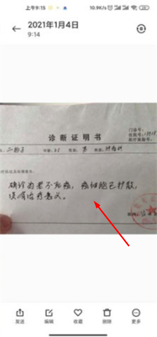 病历单p图
